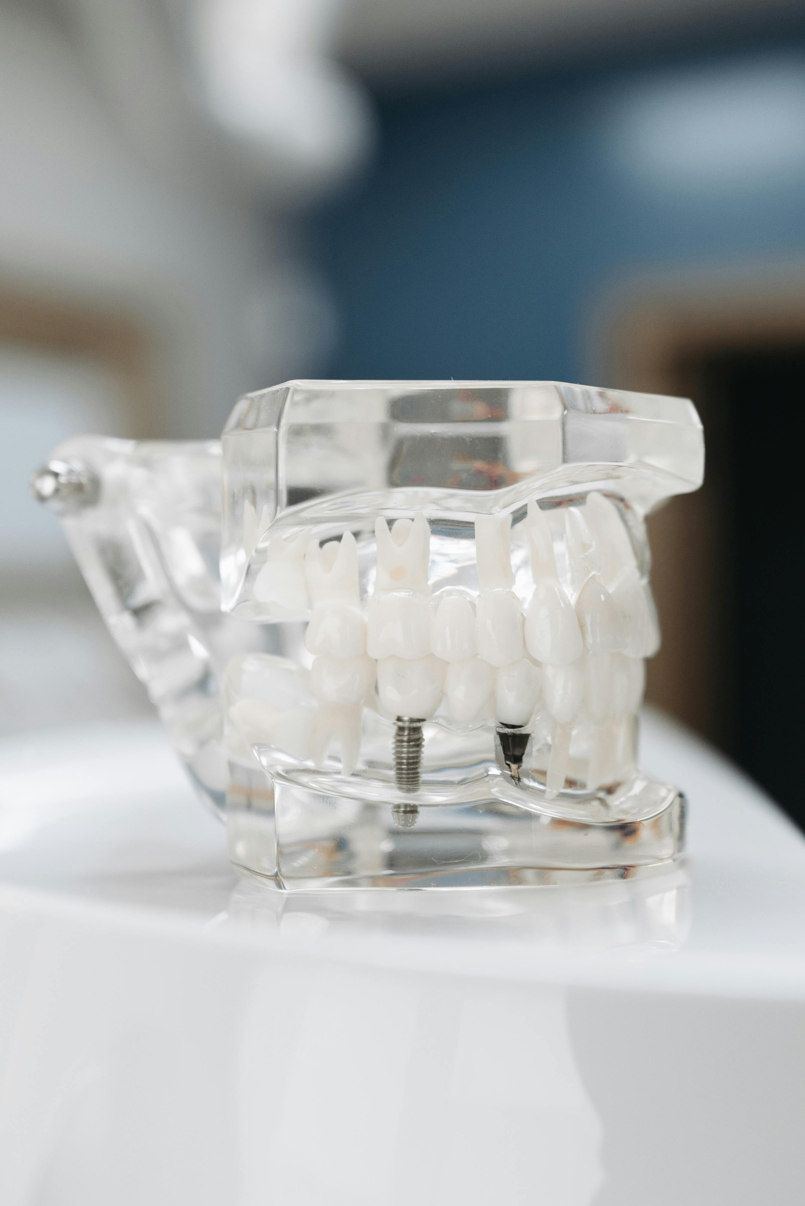 Mansioni e collaborazione dell’ASO nella chirurgia implantare